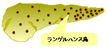 ランゲルハンス島