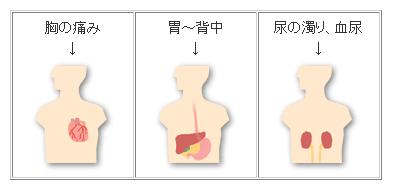 痛み の 膵臓 場所 背中 すぐできる膵臓がんの背中と腰の痛み解消法３つ